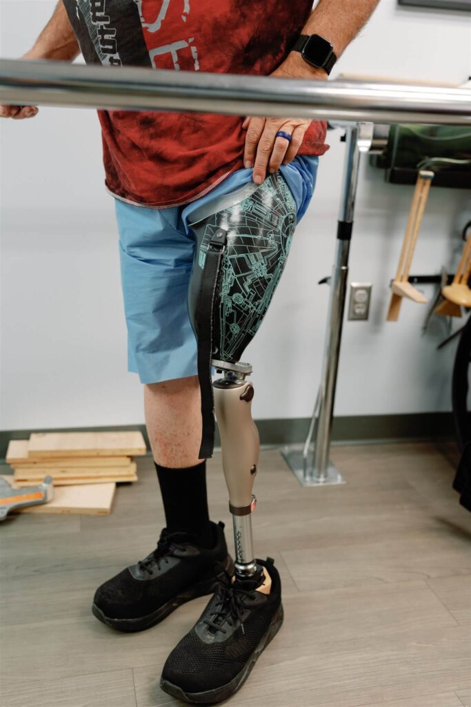 Restorative Prosthetics and Orthotics