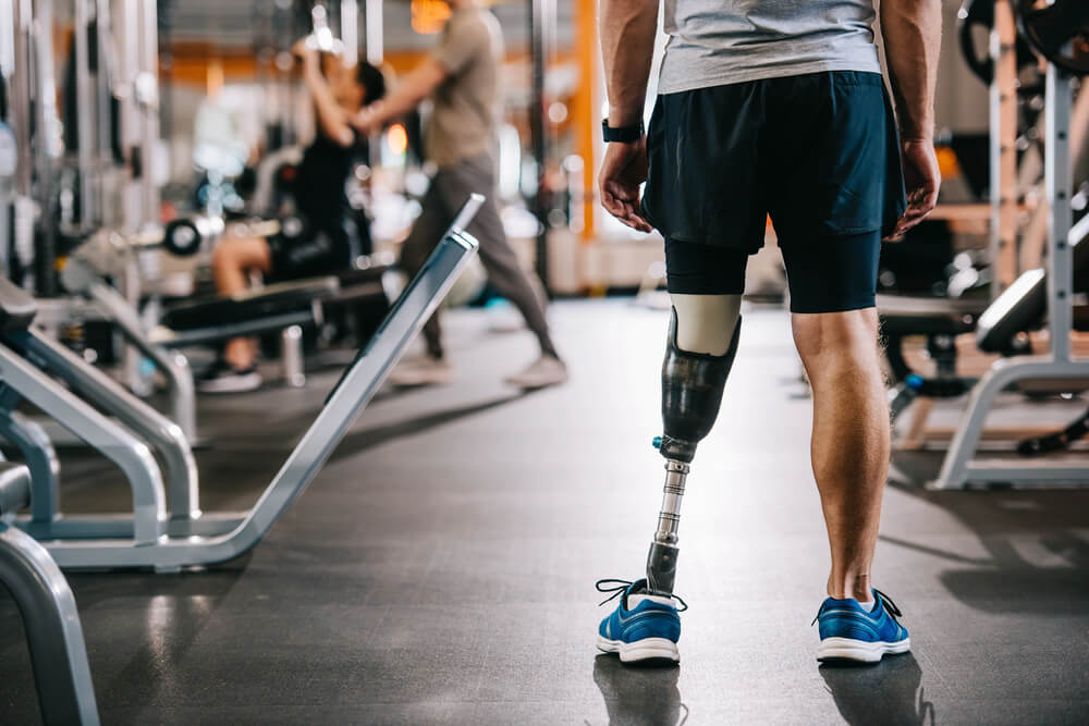 Below-the-Knee Prosthetic Leg